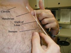the junction between the body of the sternum & manubrium ; the starting point for locating the ribs anteriorty