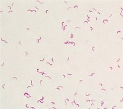 gram-negative, pink colored bacteria
 
spririllum shape