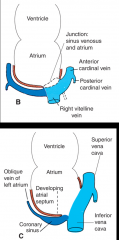 -left vitelline & common cardinal veins dissappear
-left sinus horn shrinks & becomes oblique vein of left atrium & coronary sinus