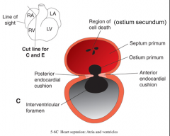 ostium secundum (perforations)

maintain blood flow from the R to L primitive atrium