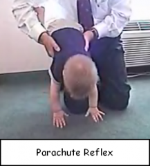 Extend arms when turned upside down
Appears at 6-8 months and persists
