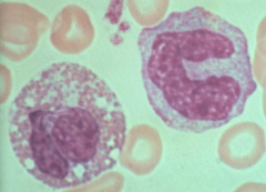 Hvilke tre typer blodceller ser vi her?