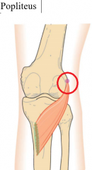 lateral condyle of femur