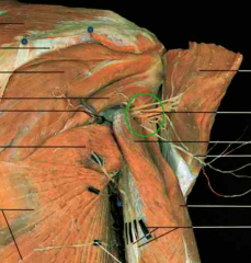 Axillary Nerve + Posterior Circumflex humeral artery