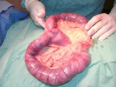 What is a pyometra and its cause?