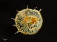 i) An amoeba with lobe-like pseudopodia, generally no shell