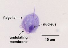 Species – vaginalis; feeds on epithelial cells of the vagina and male eurethra, causing infections
