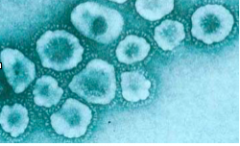 1. What family of virus? Structure?
a. Coronavirus
b. Picornavirus
c. Retrovirus
d. Calicivirus
e. Togavirus
f. Flavivirus 

2. Properties? 
a. respiratory droplets
b. epidemic viral gastroenteritis with vomiting and diarrhea
c. Severe ...