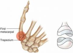 -biaxial 

-each member has a reciprocally curved concave and convex surface oriented at right angles to the other; similar to condyloid joint, but allows greater movement
-flexion & extension; abduction & adduction