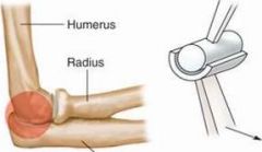 -humeroulnar joint (elbow)
-interphalangeal joint