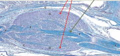 You have ganglion cells in perpherary and nerve fiber is centralized