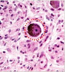 Sattellite cells that form a ring around a ganglion cells