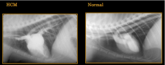 Hypertrophic cardiomyopathy

pathophysiology:

Common Radiographic Findings: