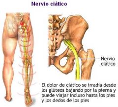 Nervio ciatico mayor
Arteria y nervio pudendo interno
Vasos y nervios gluteos superiores
Musculo pisiforme