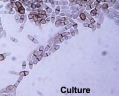 i.	2-celled oval yeast in skin scrapings