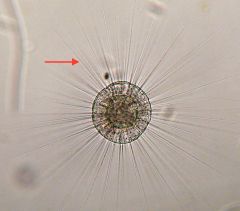 This structure is characteristic of Phylum Actinopoda. They are amoebas with numerous projections that are useful in gathering food.