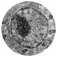 2. Prokaryotes do not have a nucleus