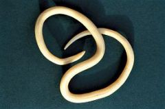 •	Unsegmented roundworms