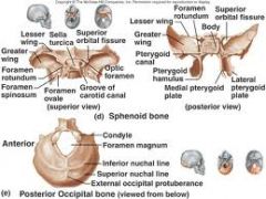 sphenoid bone