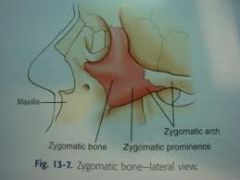 zygomatic bone