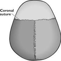 The coronal suture