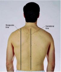 scapular, vertebral