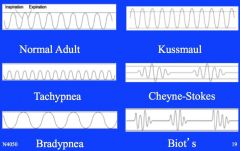 tachypnea- RR > 20; exercise, fever, pneumonia

bradypnea- RR < 12; drugs, increased intracranial pressure

kussmaul- faster than normal, deep hyperventilation; anxiety, fear, diabetic ketoacidosis

cheyne-stokes- waxing and weaning w/ perio...