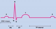 records all the cells in the heart

1/ P wave- depolarization of atria once SA node fires
2/ PR- represents AV nodal delay
3/ QRS- depolarization of both ventricles
4/ ST- ejection of blood from ventricles
5/ T- repolarization of both ventri...
