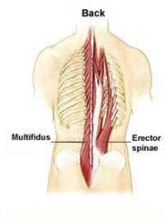 Der Musculus erector spinae (Aufrichter) bezeichnet eigentlich eine größere Muskelgruppe im Bereich des Rückens. Diese ermöglichen unterschiedliche Bewegungen wie Streckung, Seitneigung, Rotation der Wirbelsäule. Die Aufrichtergruppe wird auc...