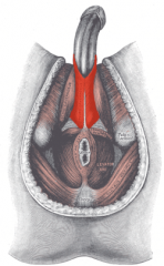 Bulbospongiosus

attach: in male from median raphe & perineal body (central tendon) to surround bulb of penis; in female from the perineal body to surround vestibular bulb, vaginal orifice, & clitoris.
action: in male empties urethra, maintains...