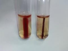A motility test is looking for the ability of an organism to move through the medium.   Growth throughout the medium beyond the prick indicates motility (left test tube in the picture)