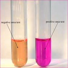 The urease test is looking for production of urease.  Urea is broken down into 2 ammonia molecules + CO2 which increases pH and shows a positive result.  

A positive result shows a color change from light peach to bright pink.