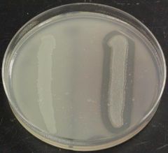 The clearing is only observed after 1N HCl has been added to the plate to precipitate the DNA.
Clearing of DNA around the bacteria is positive.
No clearing around the bacteria is negative.