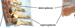 *connects apexes of spineous processes of adjacent verts

*limits hyperflexion