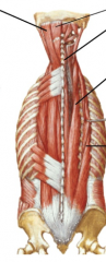 What are the intrinsic muscles of the back?
