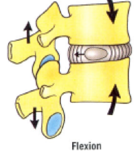 age: IV disks tend to dry out and become more fragile
bad movements: pressure with lifting boxes from flexion pops nucleus pulposus into foramen