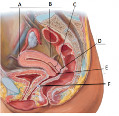 A=fundus, above fallopian tubes
B=isthmus, constriction, divides fundus/cervix
C=cervix, internal os-->external os
D=posterior fornix (lateral,anterior exist around cervix too)
E=external os
F=vagina