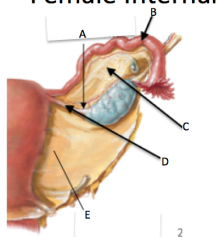 A=mesovarium
B=uterine tube
C=mesosalpinx (salpinx=fallopian)
D=proper ovarian ligament
E=mesometrium (metrium=uterus)