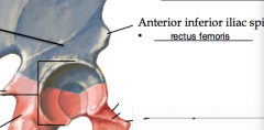 anterior inferior iliac spine