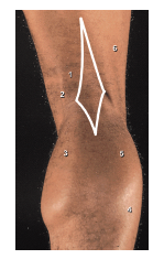 what are the boundaries of the popliteal fossa?