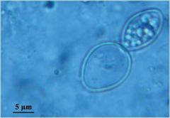 Reproductive structures of mold phase