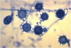 Reproductive structures of mold phase