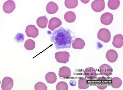 Clinical Hematology (Microscopic Images) Flashcards - Cram.com