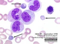 Clinical Hematology (Microscopic Images) Flashcards - Cram.com