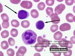 Clinical Hematology (Microscopic Images) Flashcards - Cram.com