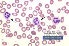 Clinical Hematology (Microscopic Images) Flashcards - Cram.com