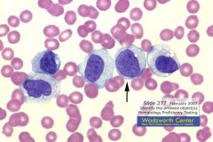 Clinical Hematology (microscopic Images) Flashcards - Cram.com