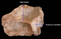 1. Falx cerebri
separate cerebral hemis. along midline
 
2. tentorium cerebelli
separate cerebral hemis from cerebellum
3. membrane covering hypophyseal (pituitary) fossa