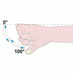Cada dedo está formado por tres falanges (a excepción del pulgar que cuenta solo con dos una proximal y una distal) , un metacarpiano y tres articulaciones (metacarpofalángica, interfalángica proximal e interfalángica distal).

las articula...
