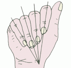 BIOMECÁNICA DE LA MANO: ¿qué debo tener en cuenta al elaborar ortesis de mano?